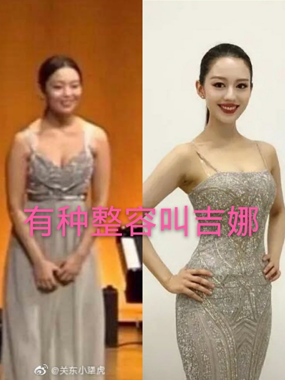 有人说吉娜肯定整容了,她从小窄双眼皮,高鼻子,小嘴