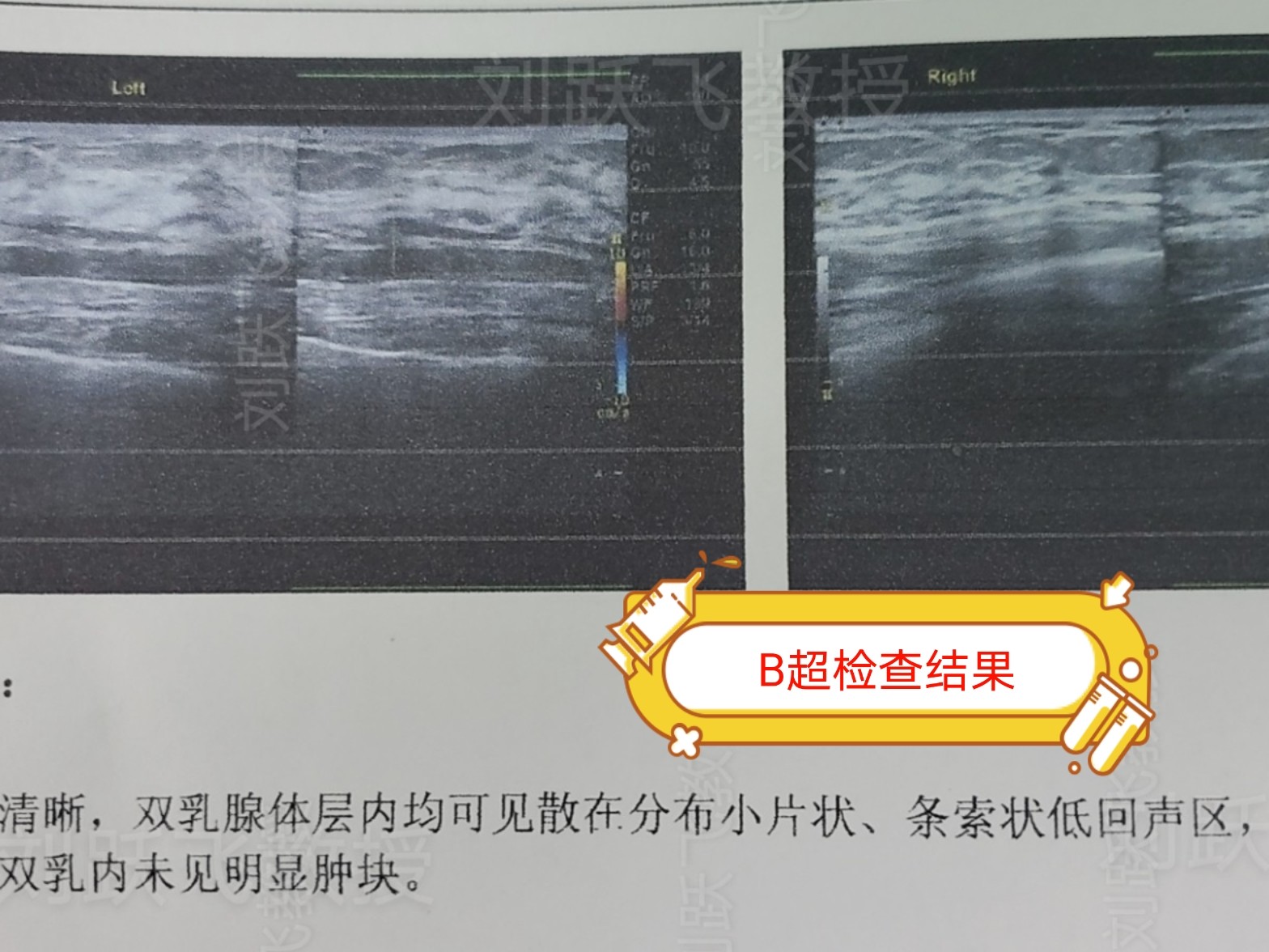 com/p26952799 脂肪隆胸后可能会出现包括:脂肪液化 感染 血肿