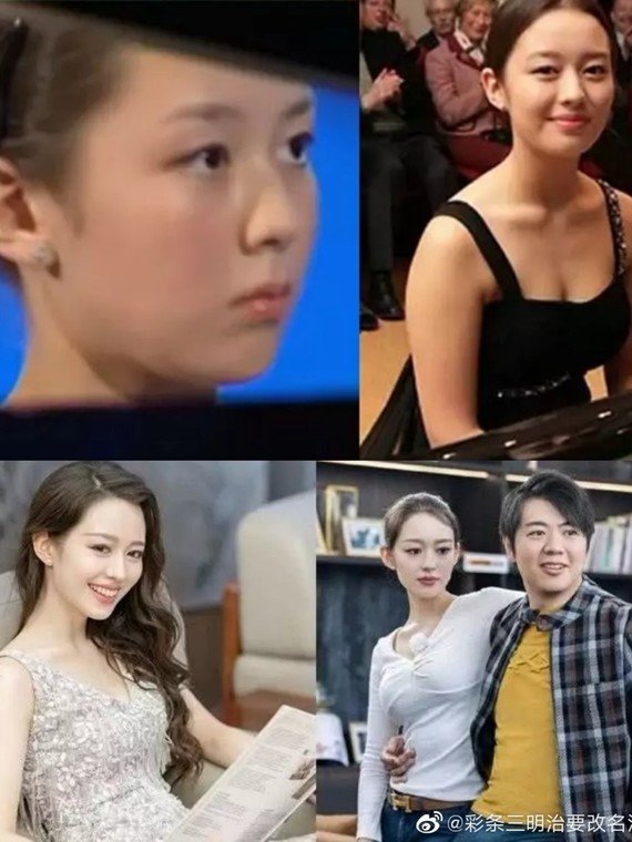 有人说吉娜肯定整容了,她从小窄双眼皮,高鼻子,小嘴