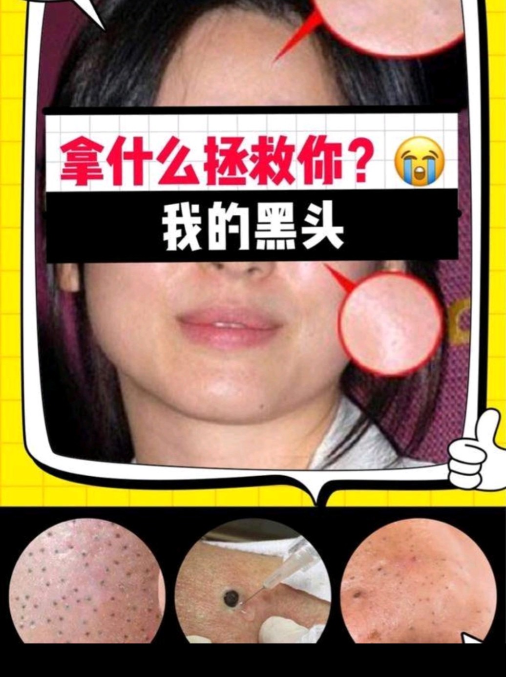 如何拯救大黑头?