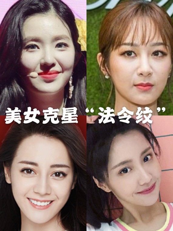 美人克星"法令纹"