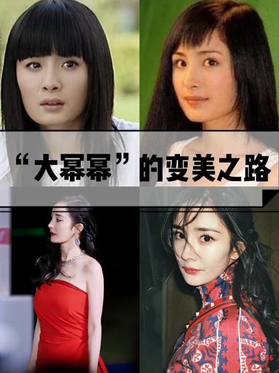 整容比较成功的明星肯定会有杨幂咯,现在也是变美了不_圈子-新氧美容