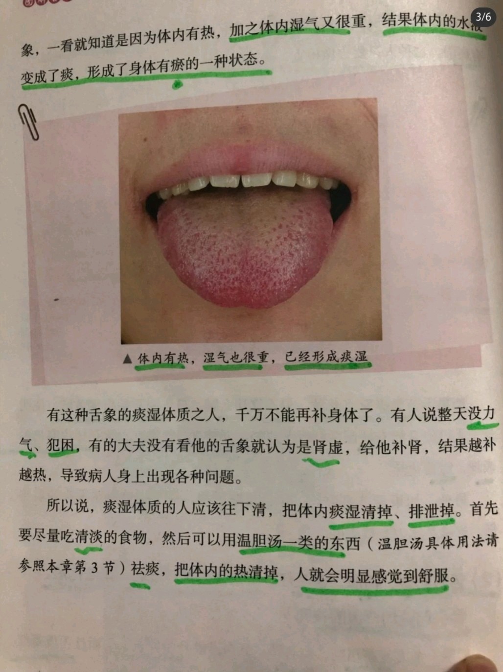 中医舌诊笔记—痰湿体质舌象及保养方法9661516