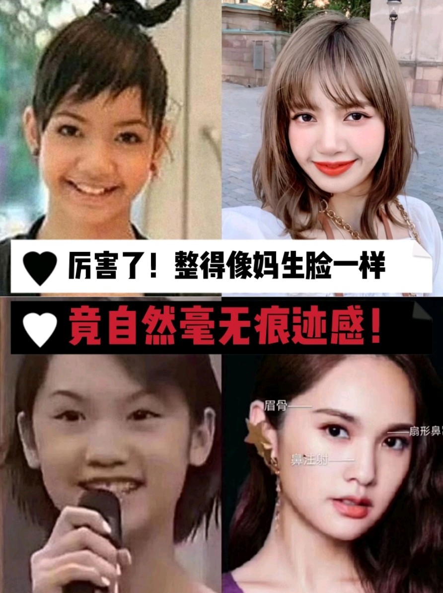 天呐她们竟整得像妈生脸一样自然