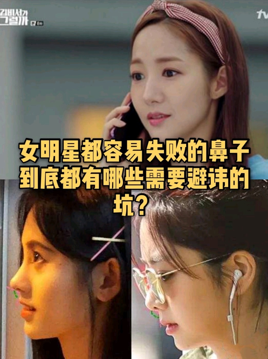 97 连女明星都交了智商税的鼻整形,到底应该避开哪些_圈子-新氧美容