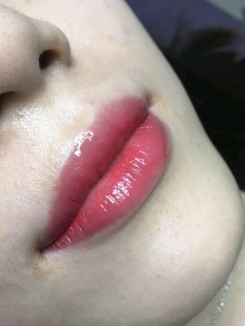 效果超出预期,值得信赖,解答全面,专业,无额外费用_圈子-新氧美容整形