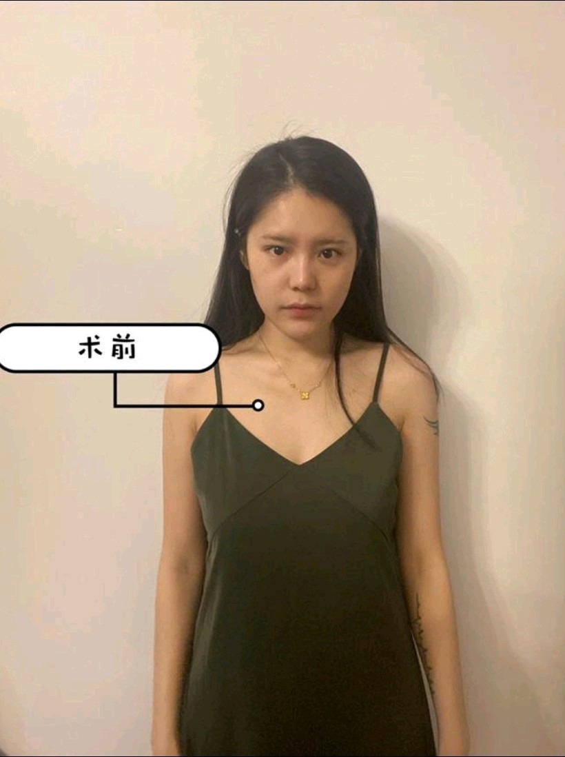 95159815干货心得分享95159815假体隆胸,会被男朋友