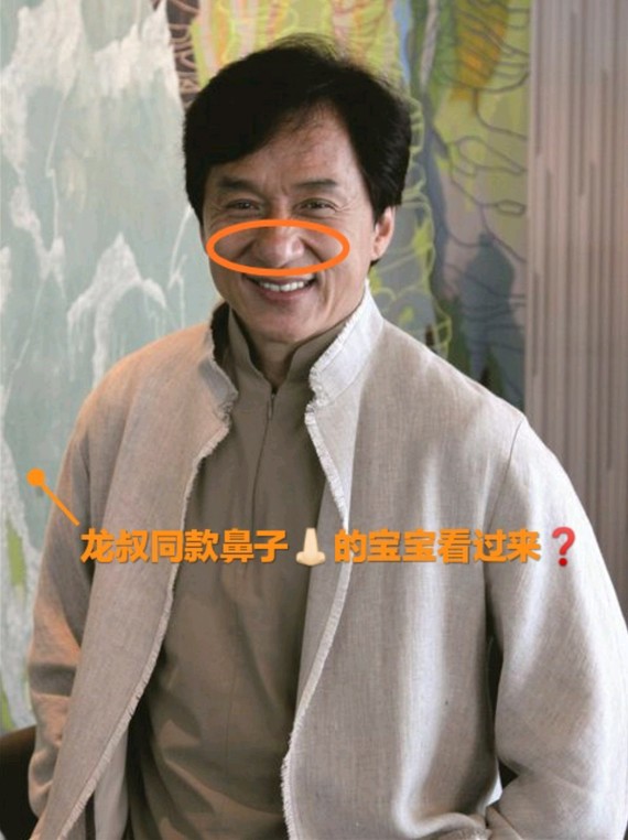 如果你是"龙叔"的鼻子,激光祛红血丝一招治好