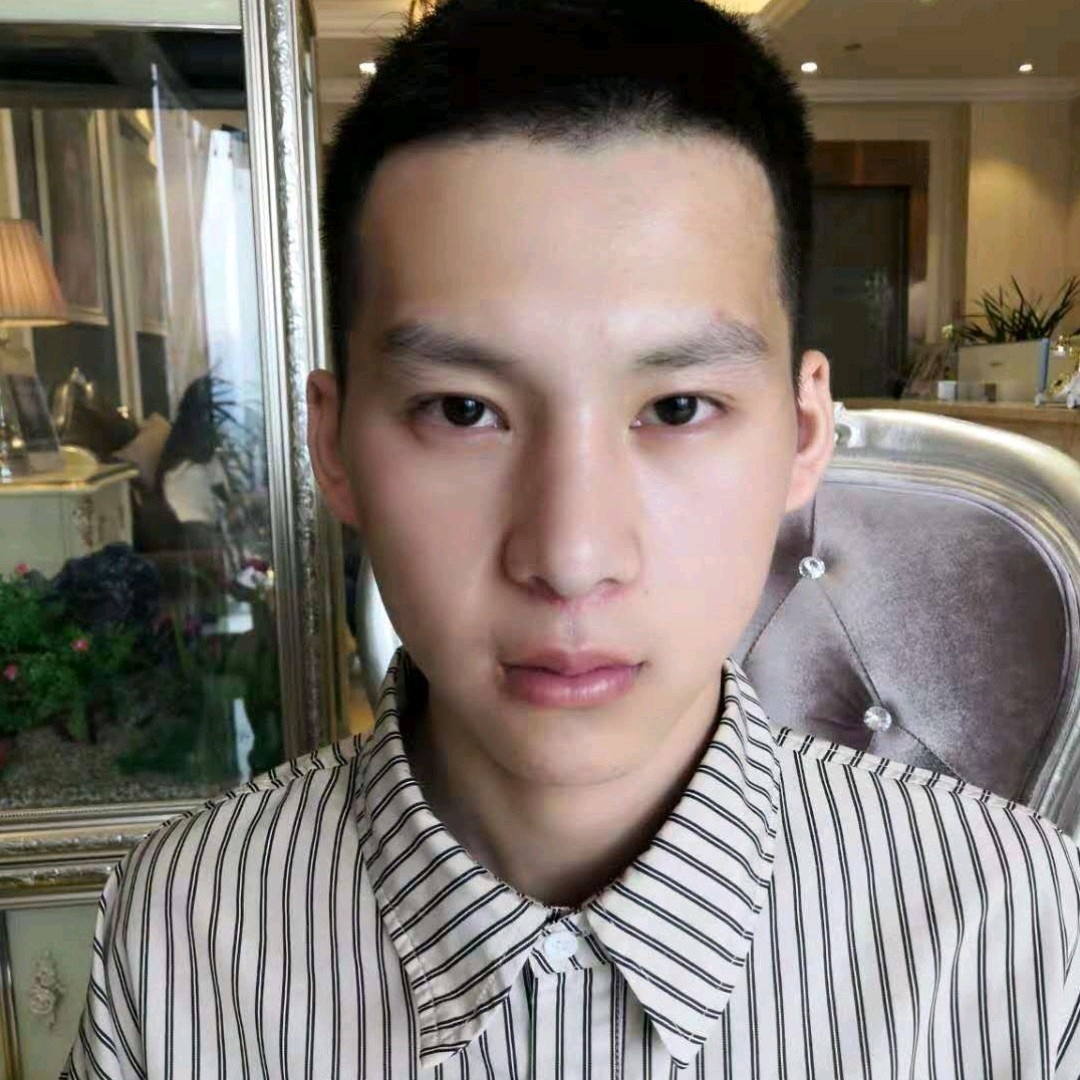 【假体丰下巴】【膨体垫下巴】男士man下巴,更显刚硬轮廓线条