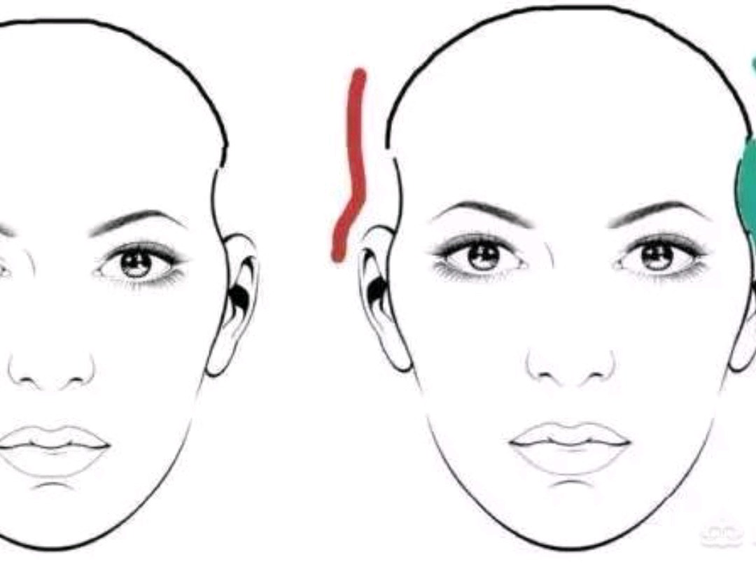 太阳穴在面相学中被称为夫妻宫,太阳穴凹陷不仅让你的脸型线条相当不