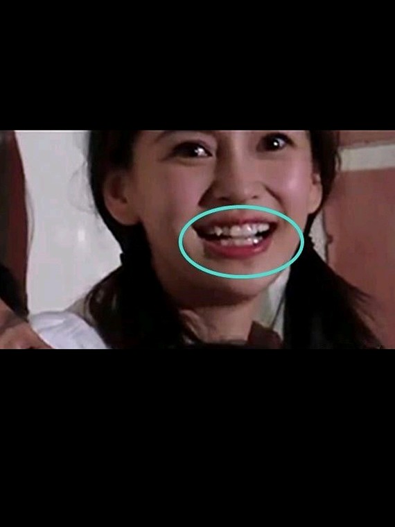 杨颖牙齿"进化史",她的牙齿怎么了,好像又长歪了16