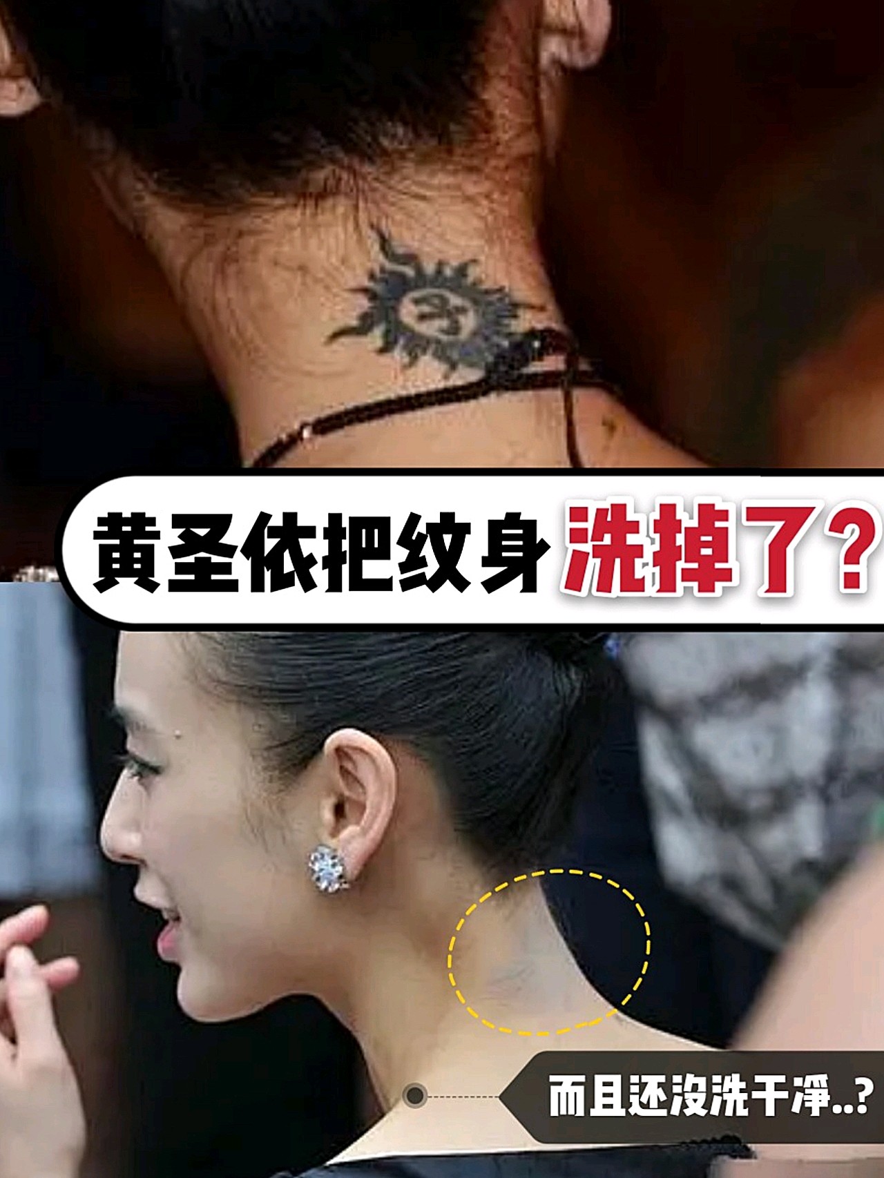 黄圣依当年的太阳纹身,现在是洗不掉了吗?