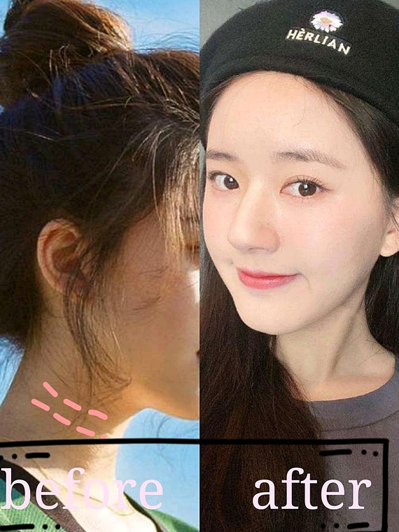 元气少女赵露思竟然也有颈纹?
