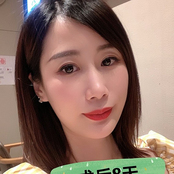 热玛吉真人案例——34岁职场女性回归少女脸的终极秘籍