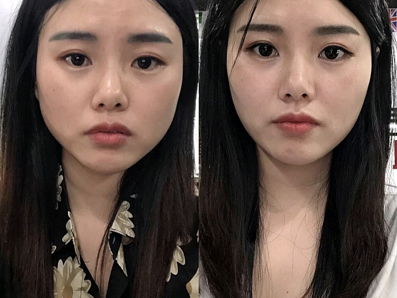 我觉得还是有效果的,咬肌比较大的朋友快点来
