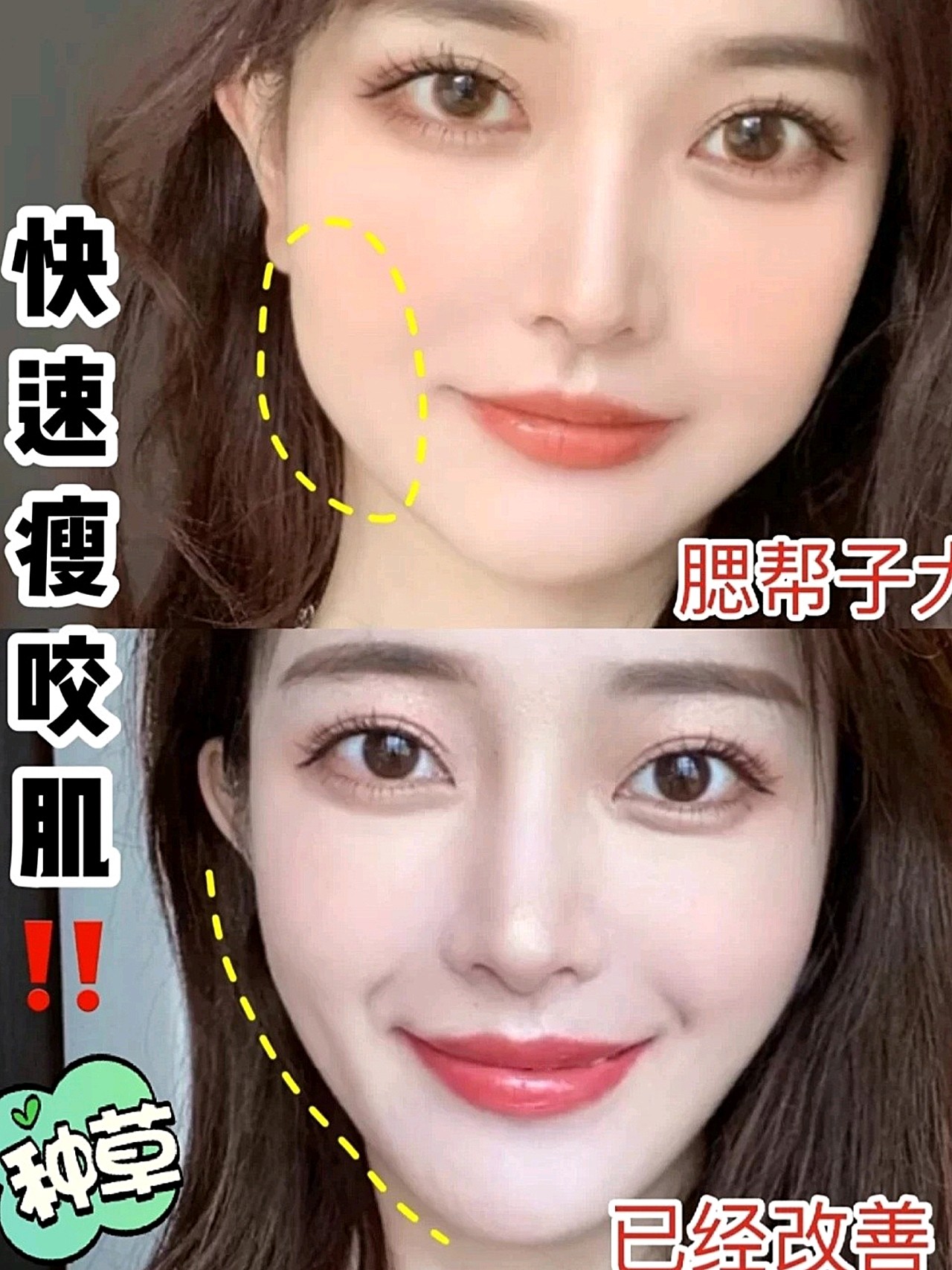大咬肌注意啦72瘦脸方法大公开60