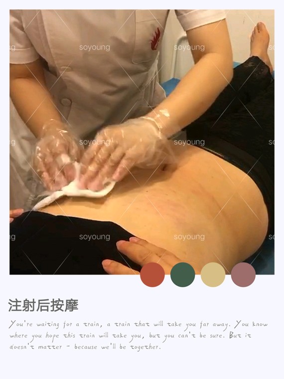 爱尔菲琳缩脂针腰腹减脂亲身体验