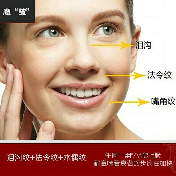 医美,我有不同观点女神最怕的"三八纹",你也中招_圈子-新氧美容整形