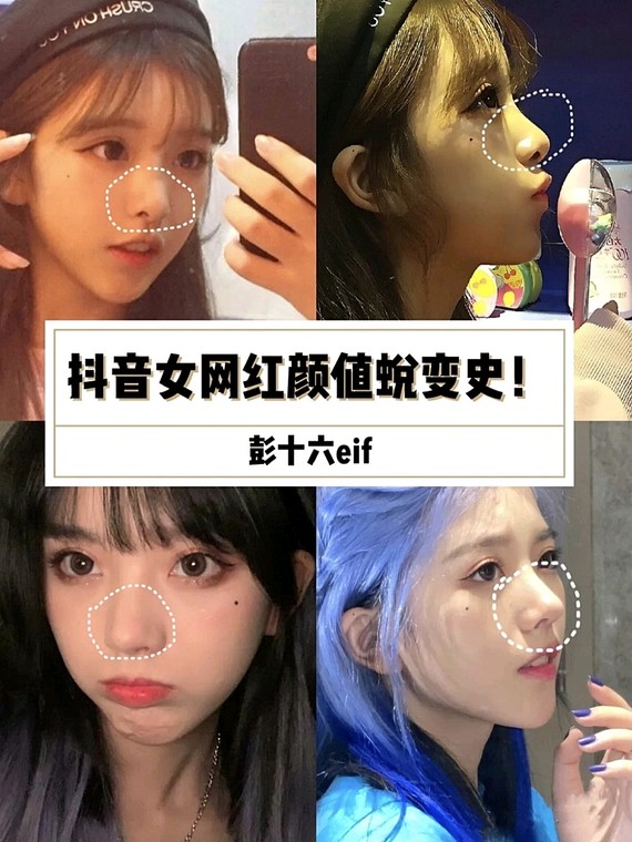 抖音女网红的颜值蜕变史-彭十六elf9696彭十六是