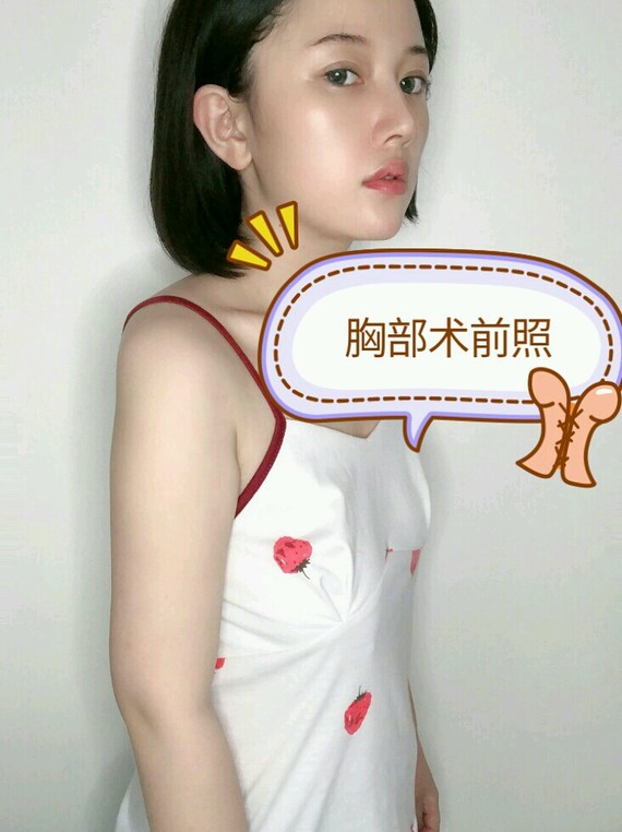 胸疼痛感没怎么感觉,大概是因为我年轻嘛,还有就是医生的技术,除了