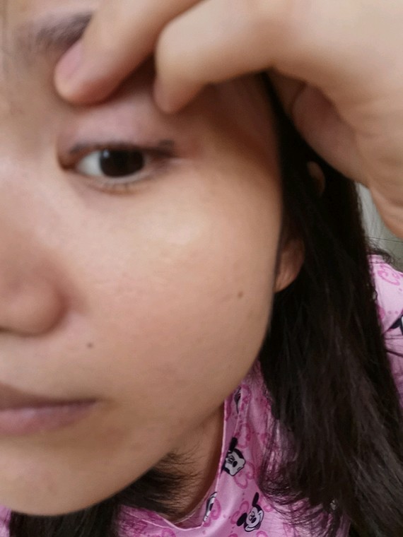 我是做皮秒洗眼线,已经洗了2次了.感觉没什么用,一