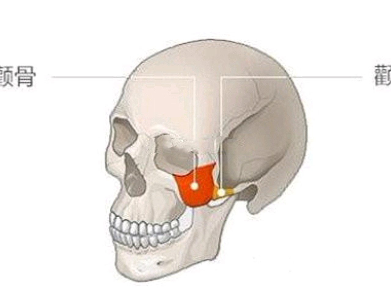 关于颧骨内推和颧弓内推的区别你知道吗?
