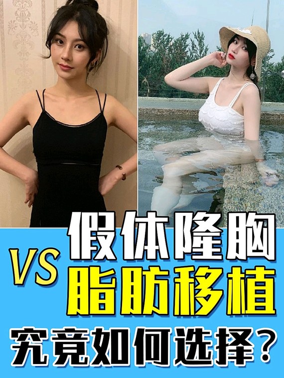 【真人案例】假体隆胸vs脂肪移植 究竟如何选择?
