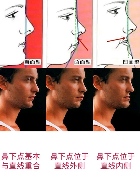 从侧脸来看,我们把一个人的脸型共分为三种情况:直面型,凸面型和凹面