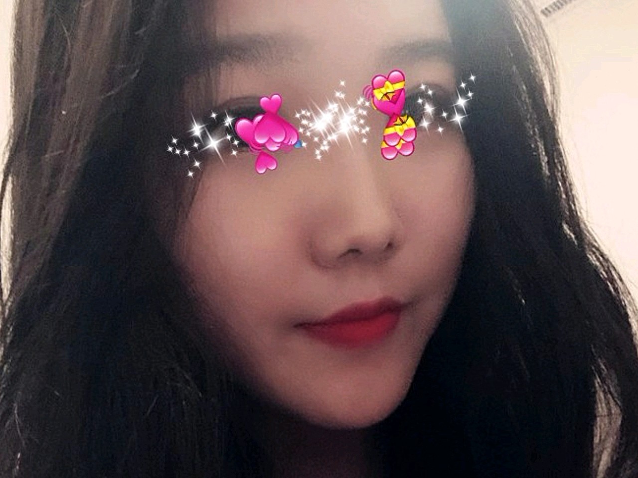 在这做玻尿酸隆鼻,一直都觉得自己的脸太平了,现在对_圈子-新氧美容