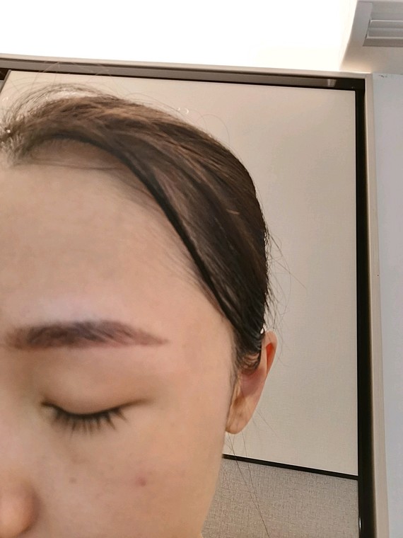 超皮秒洗眉术后第七天