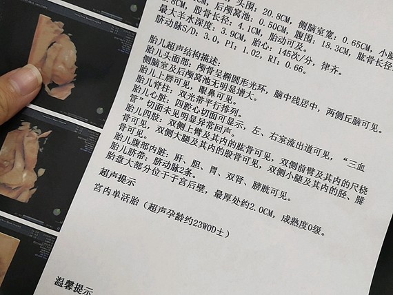 我把上次做四维彩超的时候报告单上传啦,给你们参考参_圈子-新氧美容