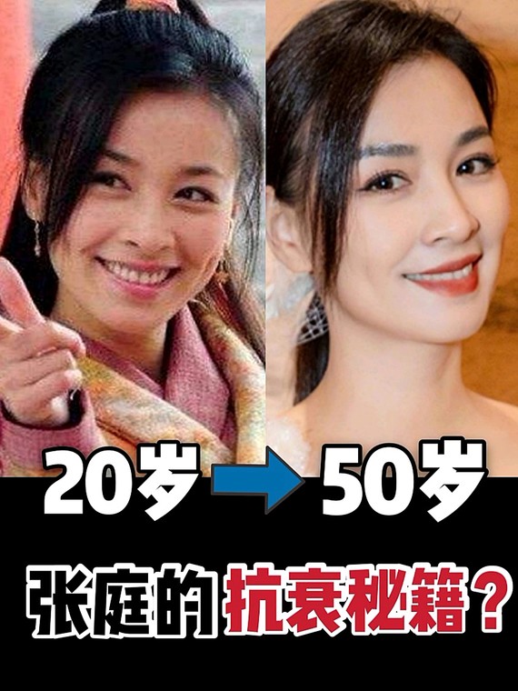 张庭是如何做到年近半百,状态依旧的?如今49岁的张_圈子-新氧美容整形