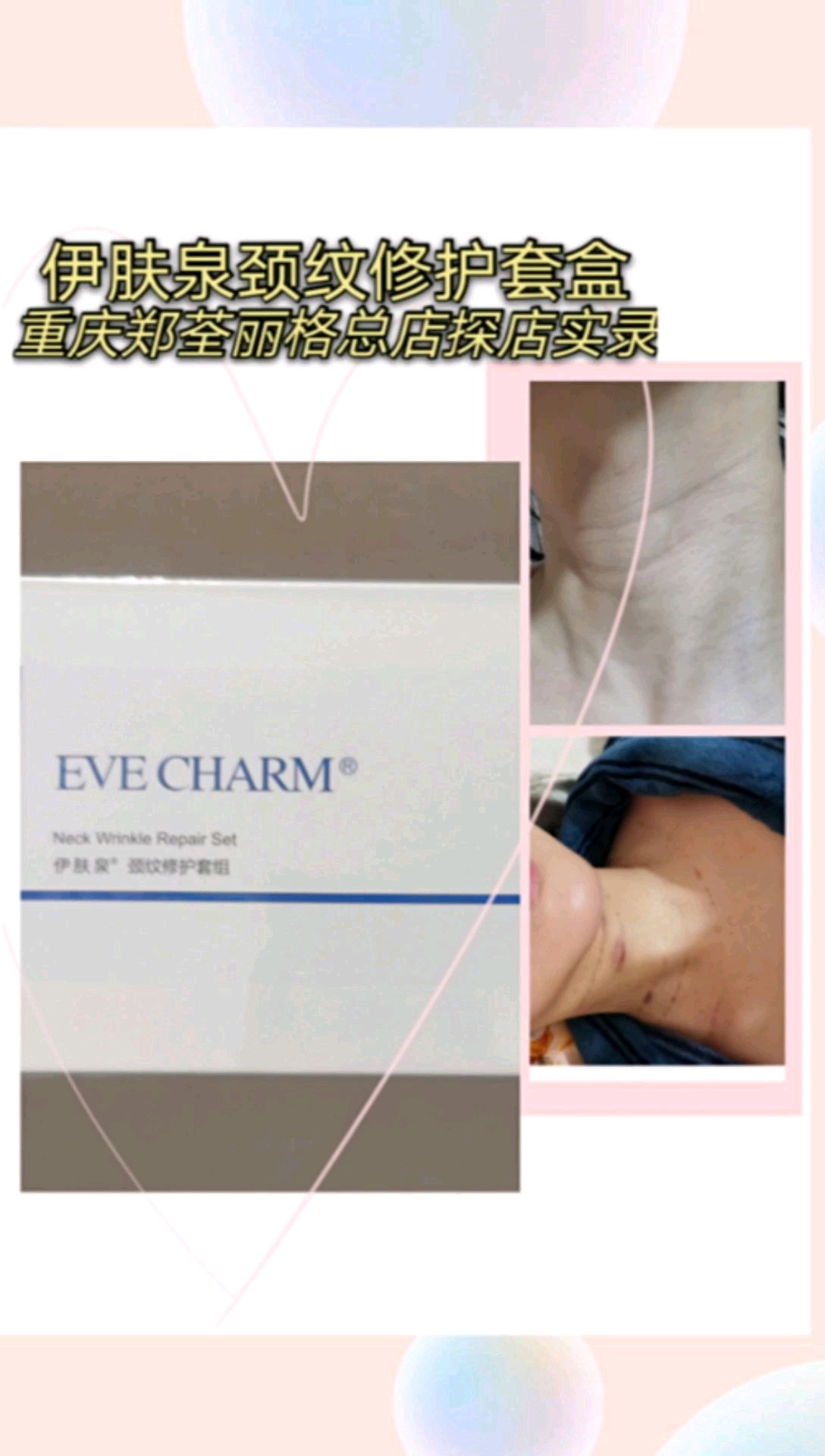 在嗨体和伊肤泉颈纹套盒纠结后,我还是选择了伊肤泉～_圈子-新氧美容