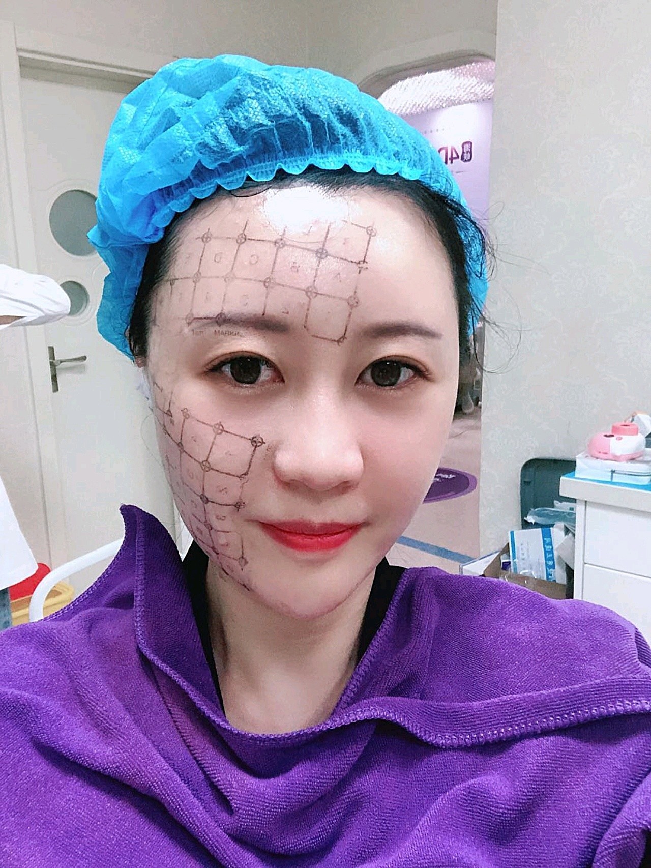 体验一下今年超火的热玛吉,平时经常对着电脑手机,加