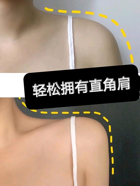 瘦肩针,轻松拥有直角肩