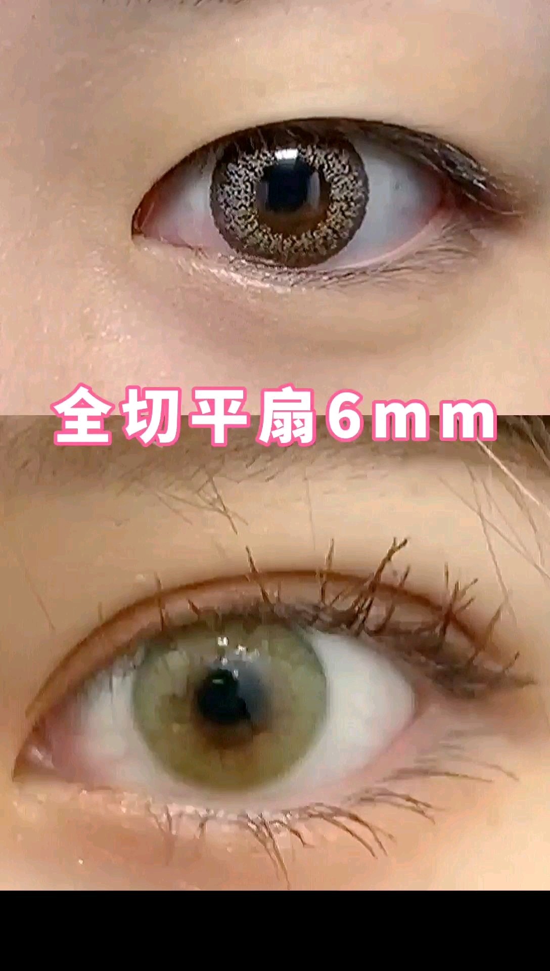 【分享】全切6mm平扇形双眼皮这个效果真的好自然!_圈子-新氧美容整形