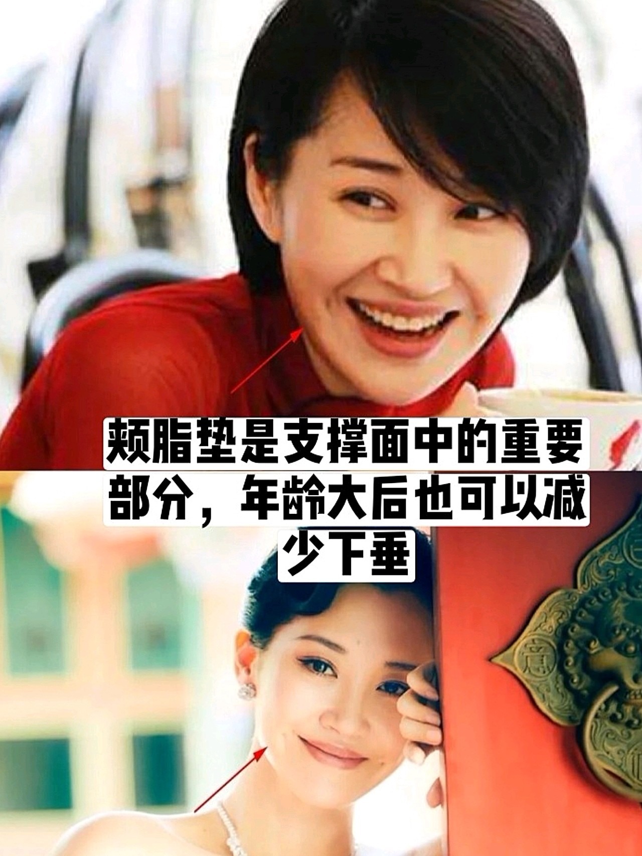 脸胖女孩决不能动它,年轻时去颊脂垫,10年后你一定_圈子-新氧美容整形