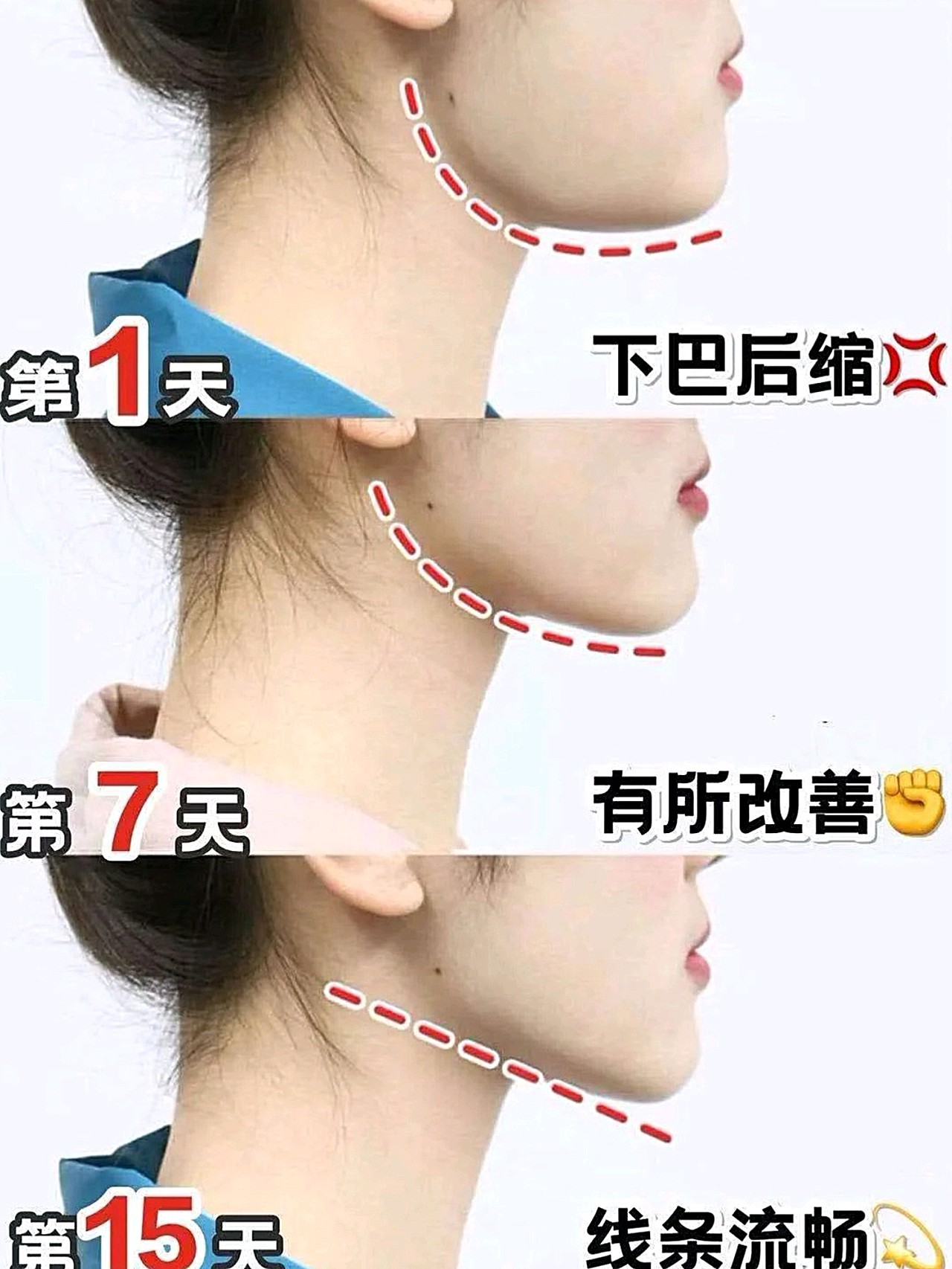 拜拜双下巴 15天养成侧颜杀,大脸必看