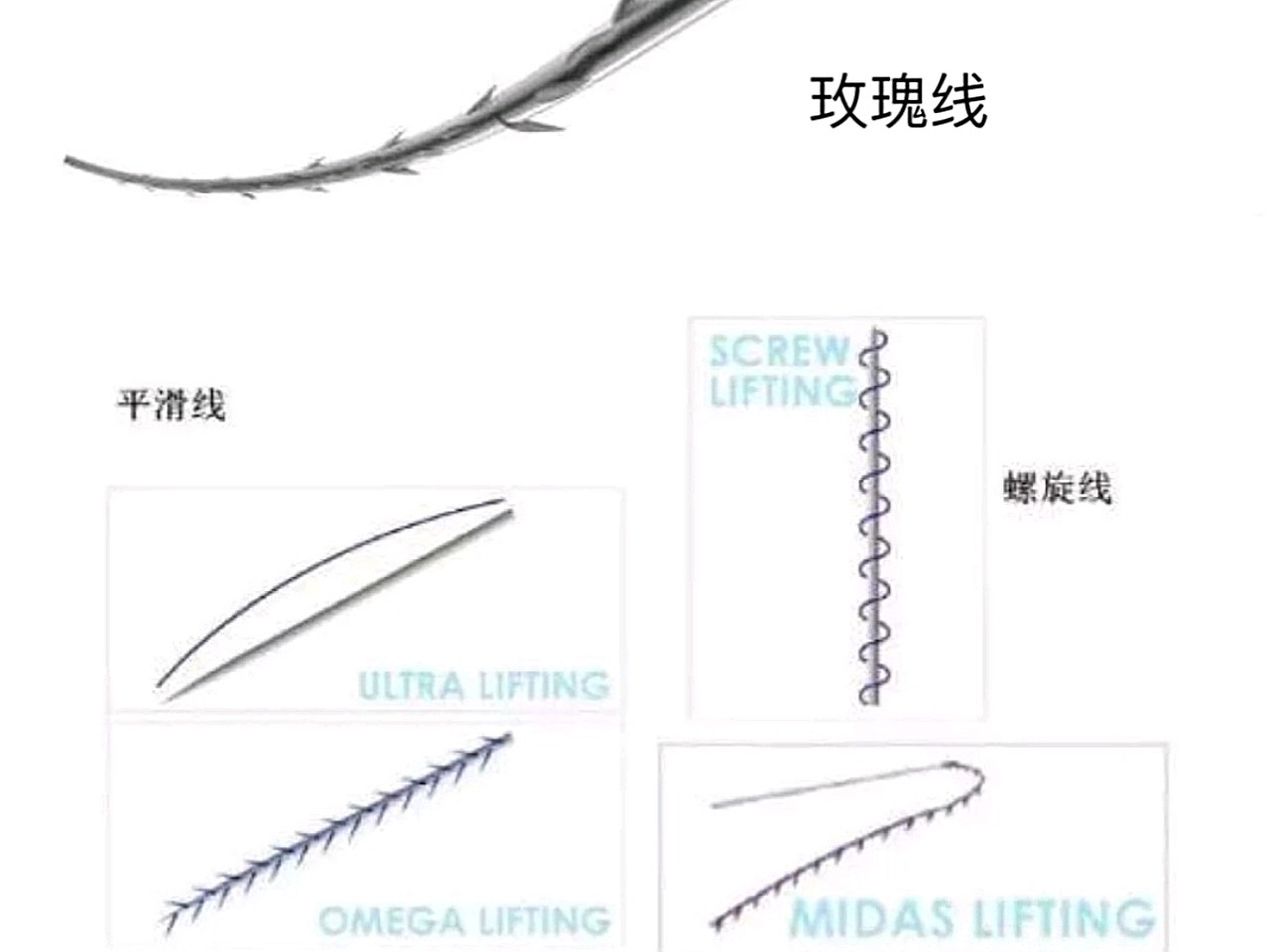 很多人在问线雕(埋线提升)的线如何选择?