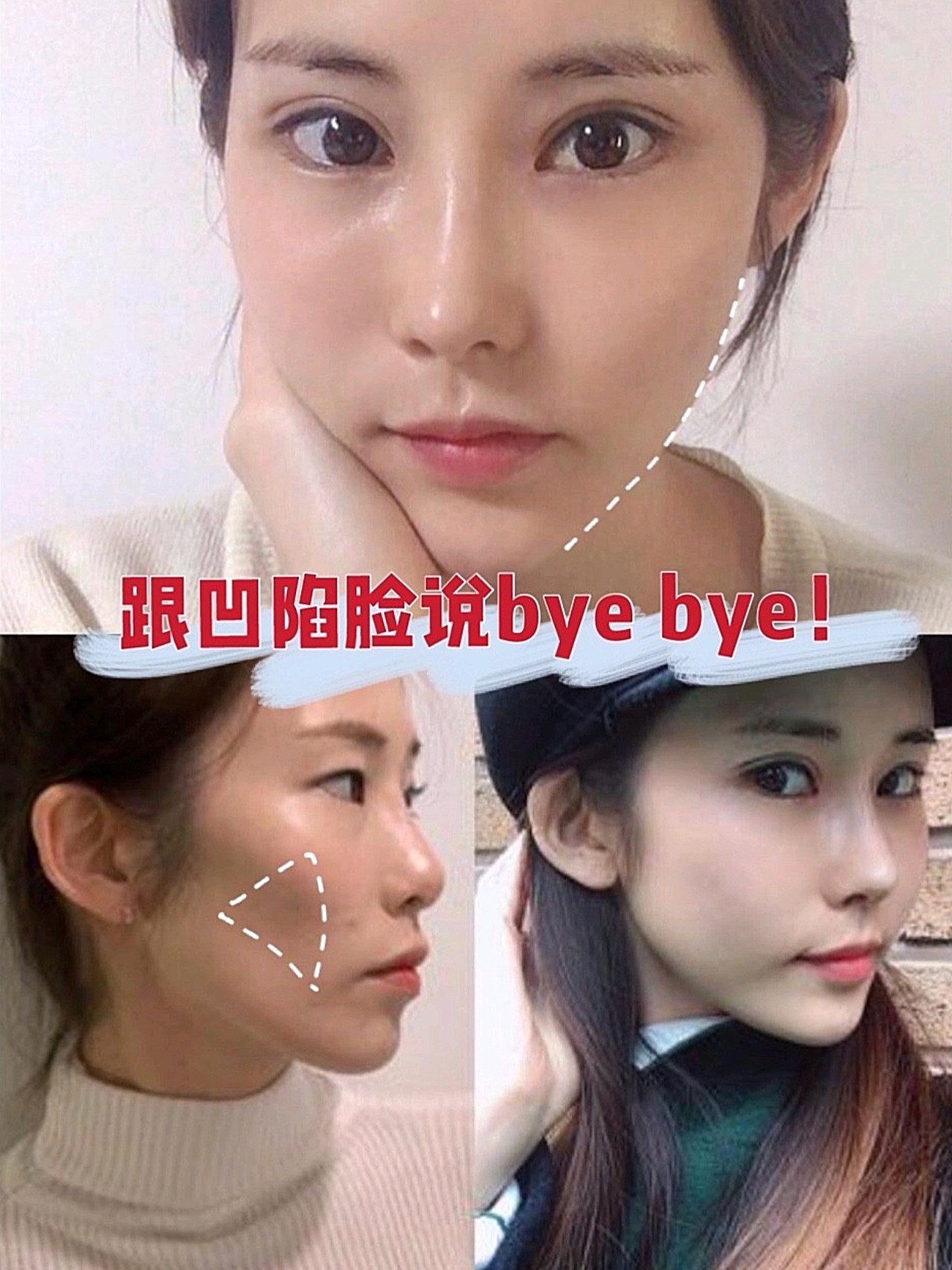 做了它,赶紧跟凹陷脸说掰掰叭!