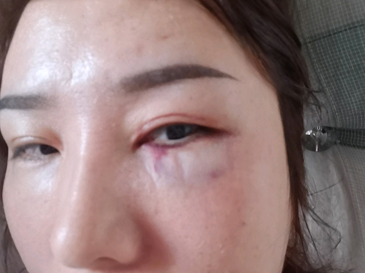 效果不满意,熊猫针打成这样!自己看吧!