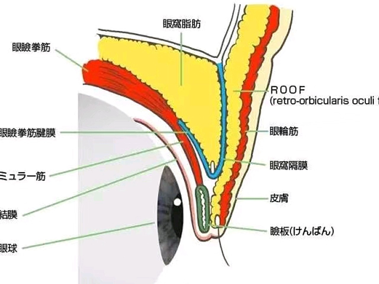 解决肿眼泡不可忽视的roof脂肪层roof层脂肪你_圈子