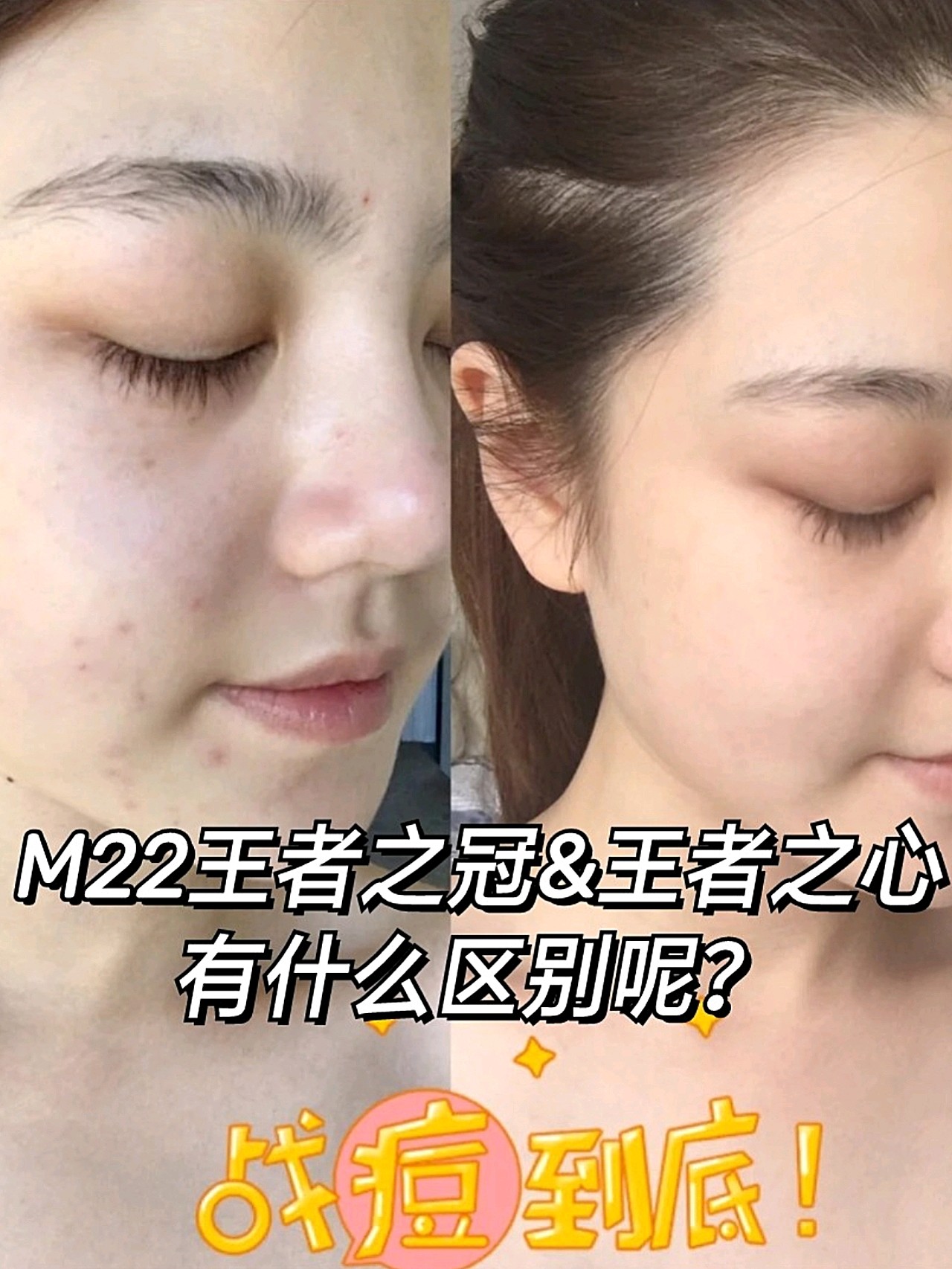 m22王者之心,王者之冠有什么区别