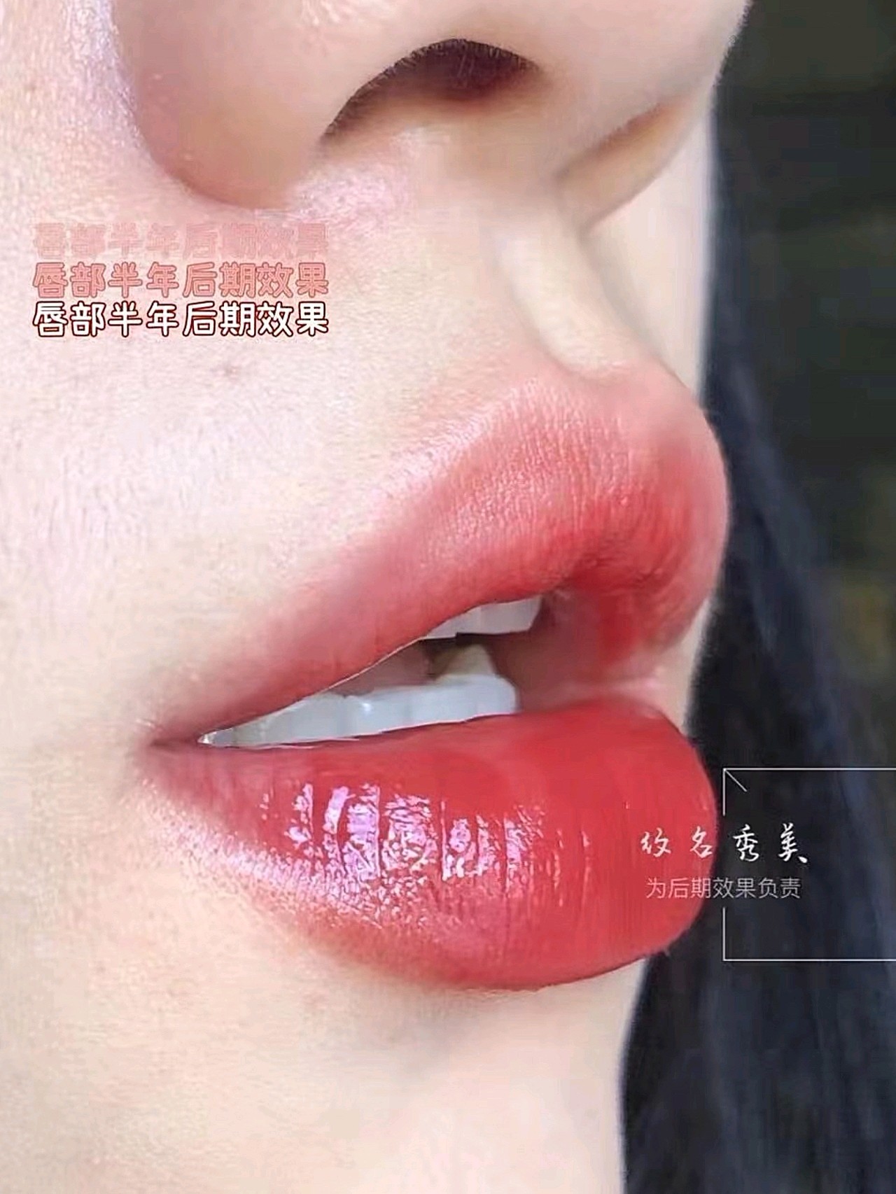 我的唇色很白,希望纹唇后可以不用天天涂唇膏.
