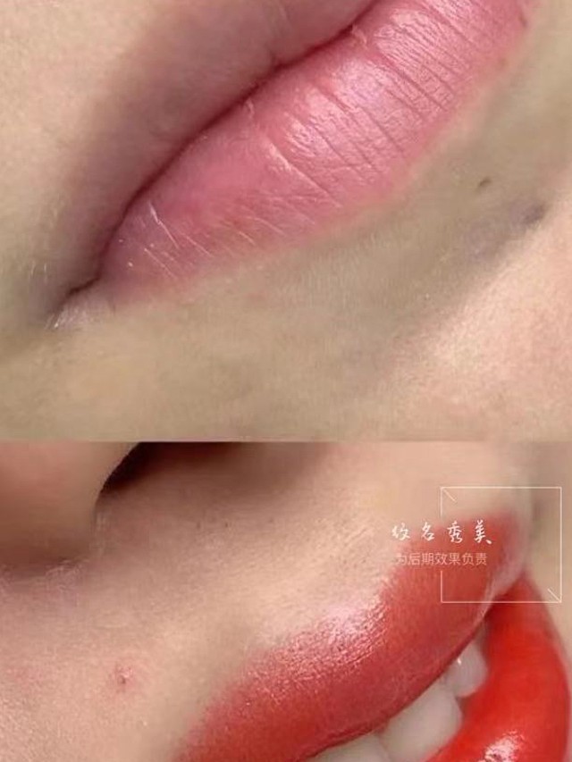 北京纹唇纹名秀美