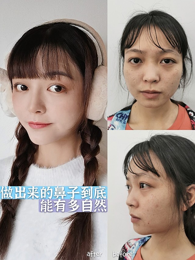 姑娘自诉,天生自己就没有鼻梁,是个塌鼻子,没有鼻型,化妆修饰后也