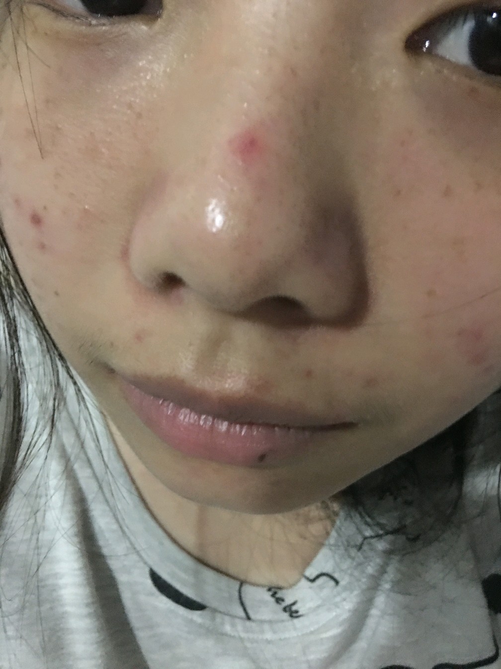鼻子前的红点怎么去掉