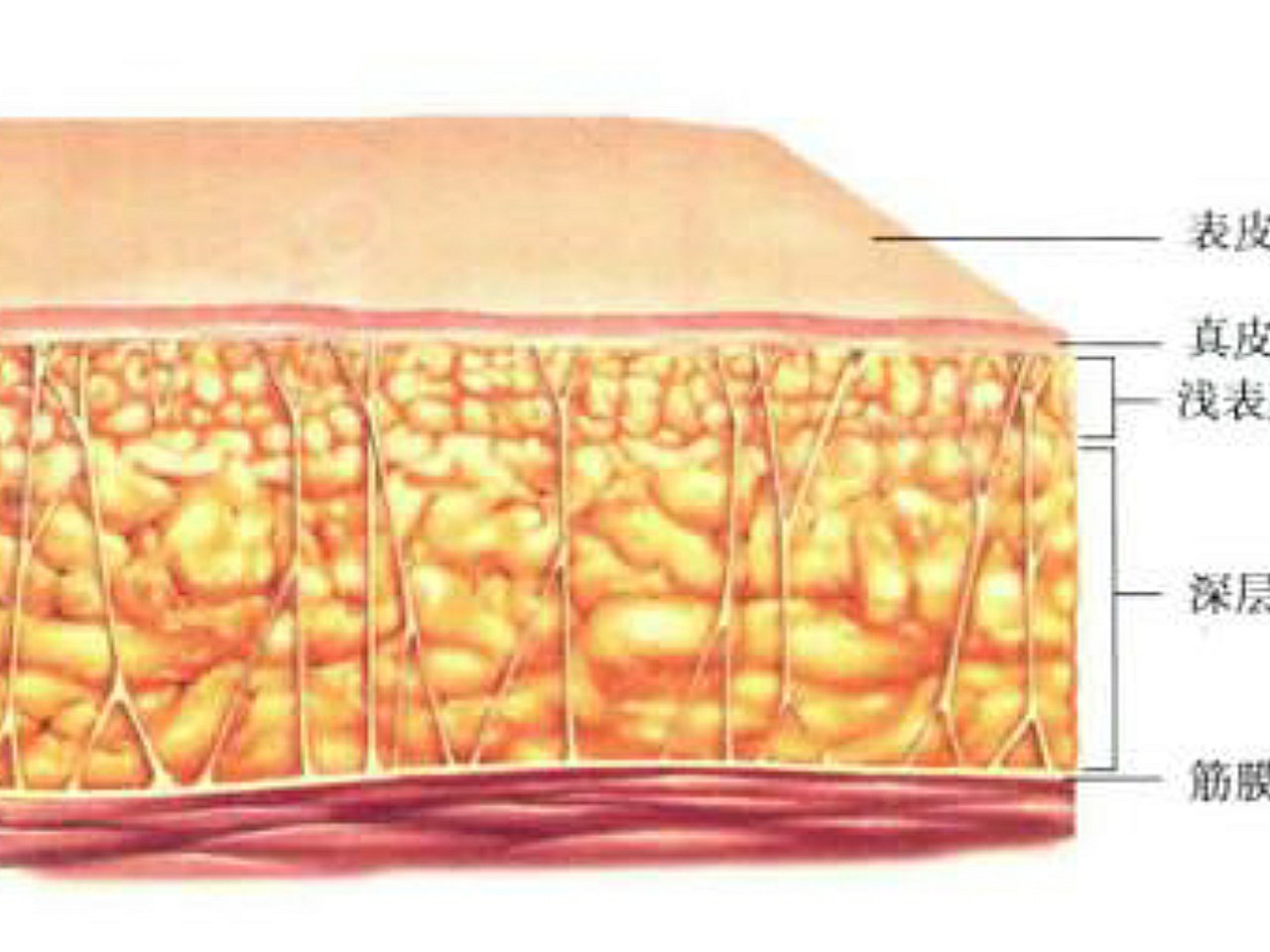 皮下脂肪通常分为三层:皮下固有脂肪层,浅层脂肪层,深层脂肪层.
