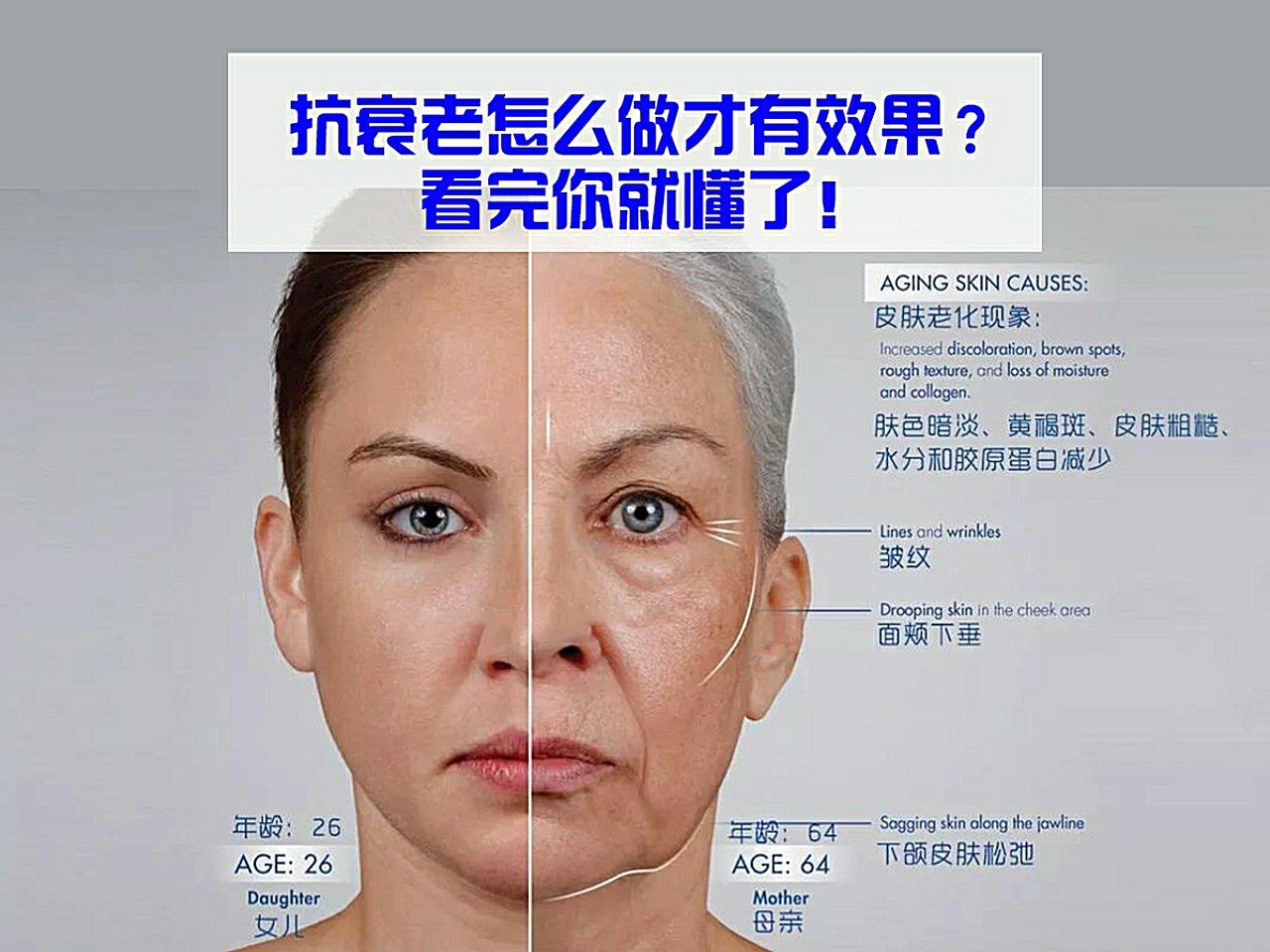 针对不同的衰老表现,我们可以采用"分层抗衰老"方法联合抵抗.