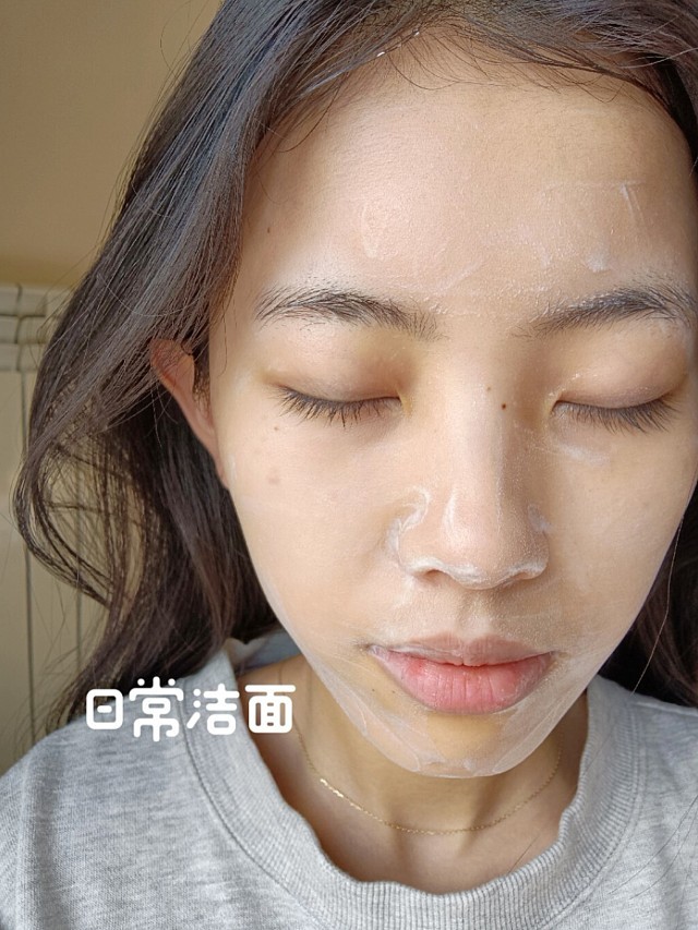 新手避坑光子嫩肤后反黑爆痘